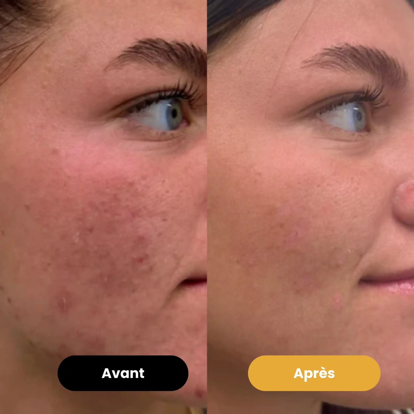 Savon au curcuma Éclaircissant - Antioxydant - Anti-inflammatoire & Antiseptique - Reach Paris