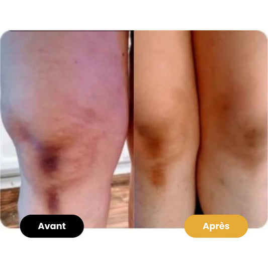Savon au curcuma Éclaircissant - Antioxydant - Anti-inflammatoire & Antiseptique - Reach Paris