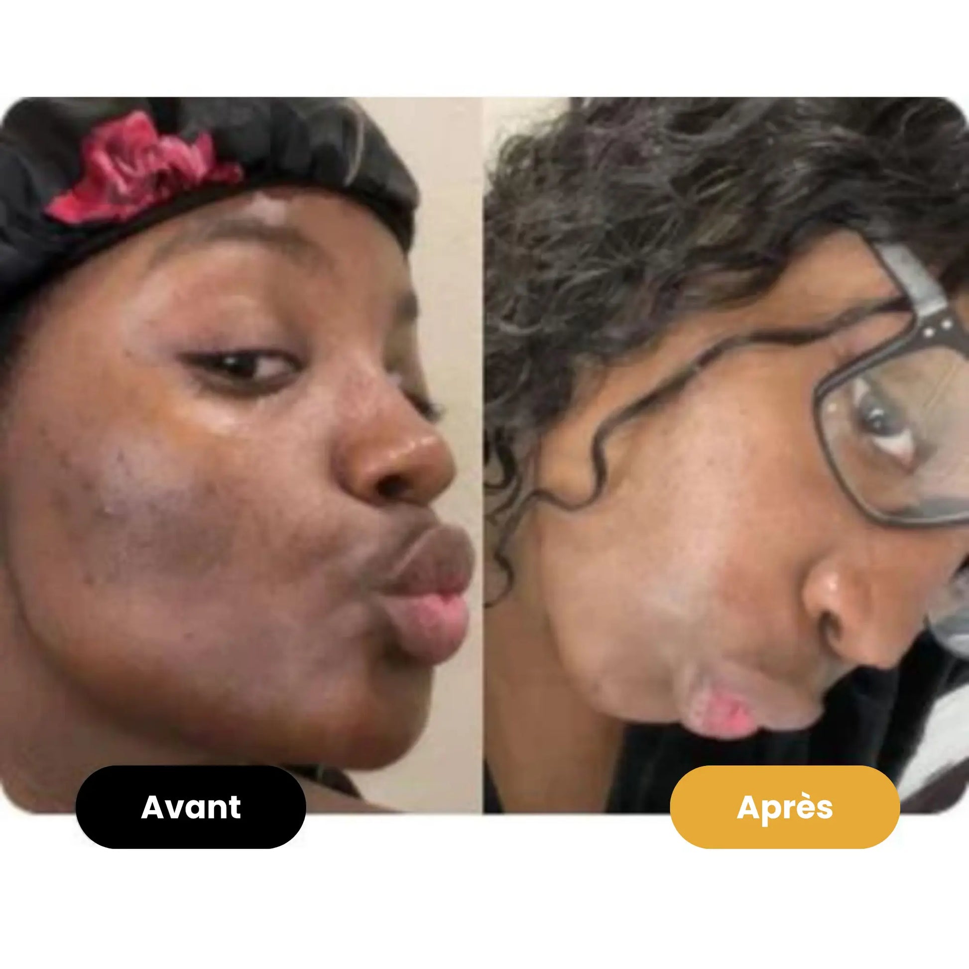 Savon au curcuma Éclaircissant - Antioxydant - Anti-inflammatoire & Antiseptique - Reach Paris